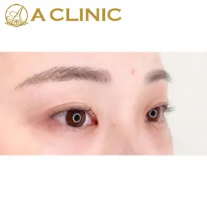 A CLINIC（エークリニック）横浜院の症例