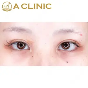 A CLINIC（エークリニック）横浜院の症例