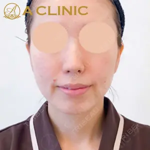 A CLINIC（エークリニック）横浜院の症例