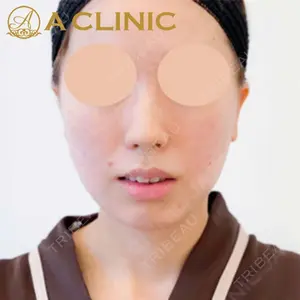 A CLINIC（エークリニック）横浜院の症例