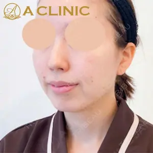 A CLINIC（エークリニック）横浜院の症例