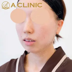 A CLINIC（エークリニック）横浜院の症例