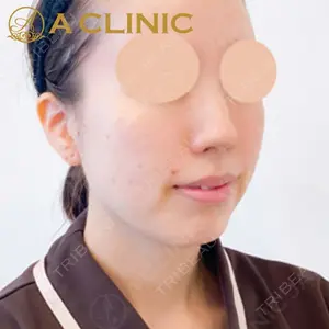 A CLINIC（エークリニック）横浜院の症例