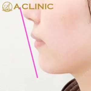 A CLINIC（エークリニック）横浜院の症例