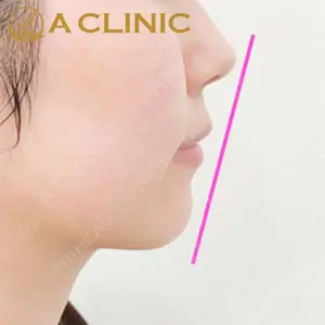 A CLINIC（エークリニック）横浜院の症例