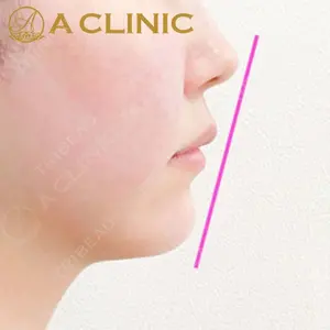 A CLINIC（エークリニック）横浜院の症例