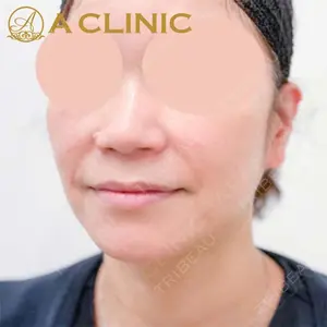 A CLINIC（エークリニック）横浜院の症例