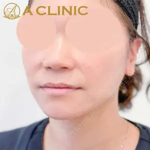 A CLINIC（エークリニック）横浜院の症例