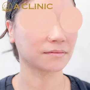 A CLINIC（エークリニック）横浜院の症例