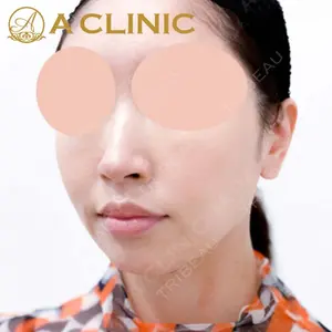 A CLINIC（エークリニック）横浜院の症例