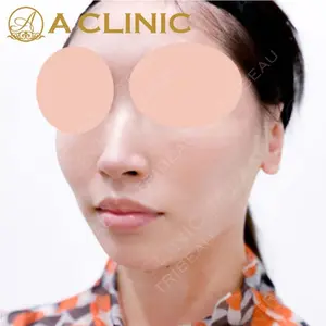 A CLINIC（エークリニック）横浜院の症例