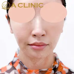 A CLINIC（エークリニック）横浜院の症例