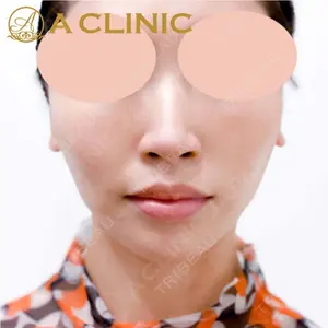 A CLINIC（エークリニック）横浜院の症例