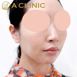 A CLINIC（エークリニック）横浜院の症例