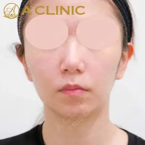 A CLINIC（エークリニック）横浜院の症例