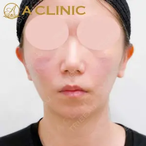 A CLINIC（エークリニック）横浜院の症例