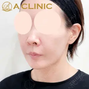 A CLINIC（エークリニック）横浜院の症例