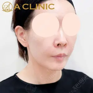 A CLINIC（エークリニック）横浜院の症例