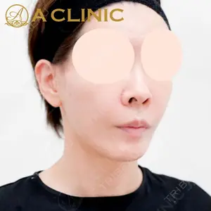 A CLINIC（エークリニック）横浜院の症例