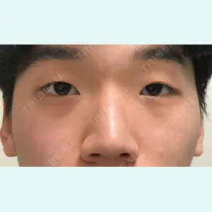 TL美容整形外科 顔面輪郭・目・鼻センターの症例