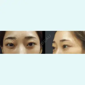 S.T styleクリニック 徳田 真紀子医師の症例