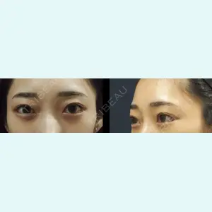 S.T styleクリニック 徳田 真紀子医師の症例
