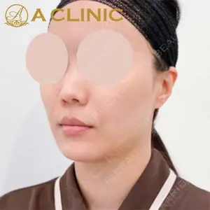 A CLINIC（エークリニック）横浜院の症例