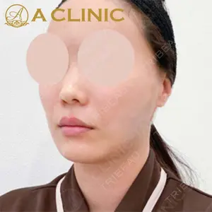 A CLINIC（エークリニック）横浜院の症例