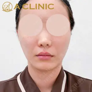 A CLINIC（エークリニック）横浜院の症例