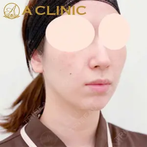 A CLINIC（エークリニック）横浜院の症例