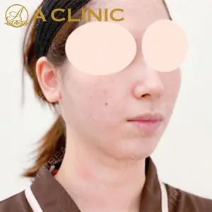 A CLINIC（エークリニック）横浜院の症例