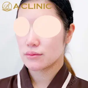 A CLINIC（エークリニック）横浜院の症例