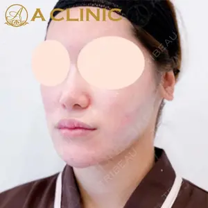 A CLINIC（エークリニック）横浜院の症例