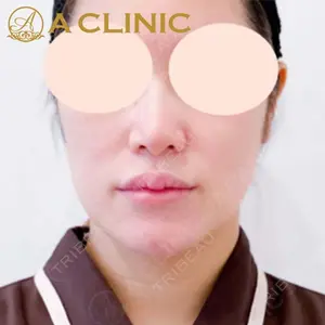 A CLINIC（エークリニック）横浜院の症例