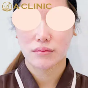 A CLINIC（エークリニック）横浜院の症例