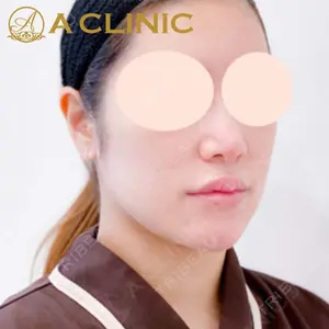 A CLINIC（エークリニック）横浜院の症例