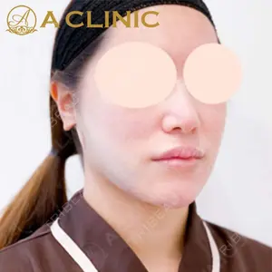 A CLINIC（エークリニック）横浜院の症例