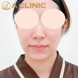 A CLINIC（エークリニック）横浜院の症例