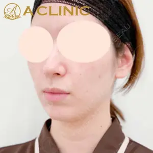 A CLINIC（エークリニック）横浜院の症例