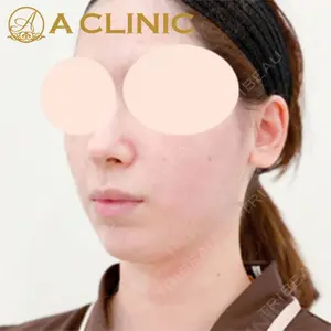 A CLINIC（エークリニック）横浜院の症例