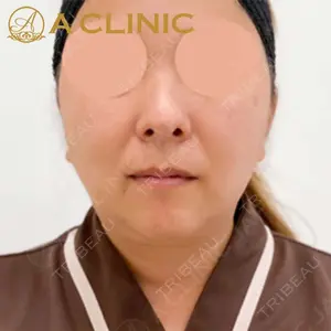 A CLINIC（エークリニック）横浜院の症例