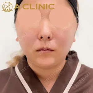 A CLINIC（エークリニック）横浜院の症例