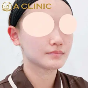 A CLINIC（エークリニック）横浜院の症例