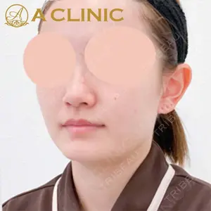 A CLINIC（エークリニック）横浜院の症例