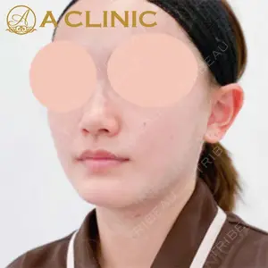 A CLINIC（エークリニック）横浜院の症例