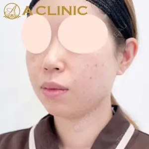 A CLINIC（エークリニック）横浜院の症例