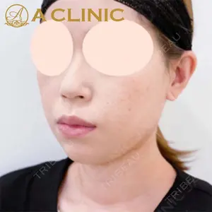 A CLINIC（エークリニック）横浜院の症例