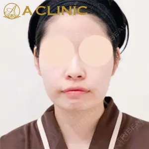 A CLINIC（エークリニック）横浜院の症例