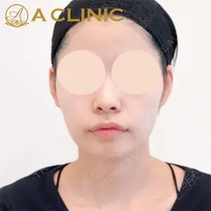 A CLINIC（エークリニック）横浜院の症例