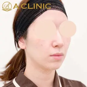 A CLINIC（エークリニック）横浜院の症例